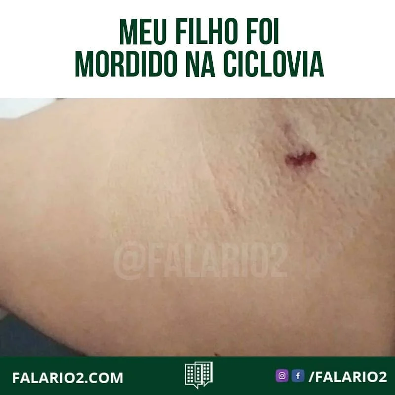 "Há 3 semanas meu filho foi atacado por um cão pastor alemão sem focinheira na ciclovia (Rio2Park).