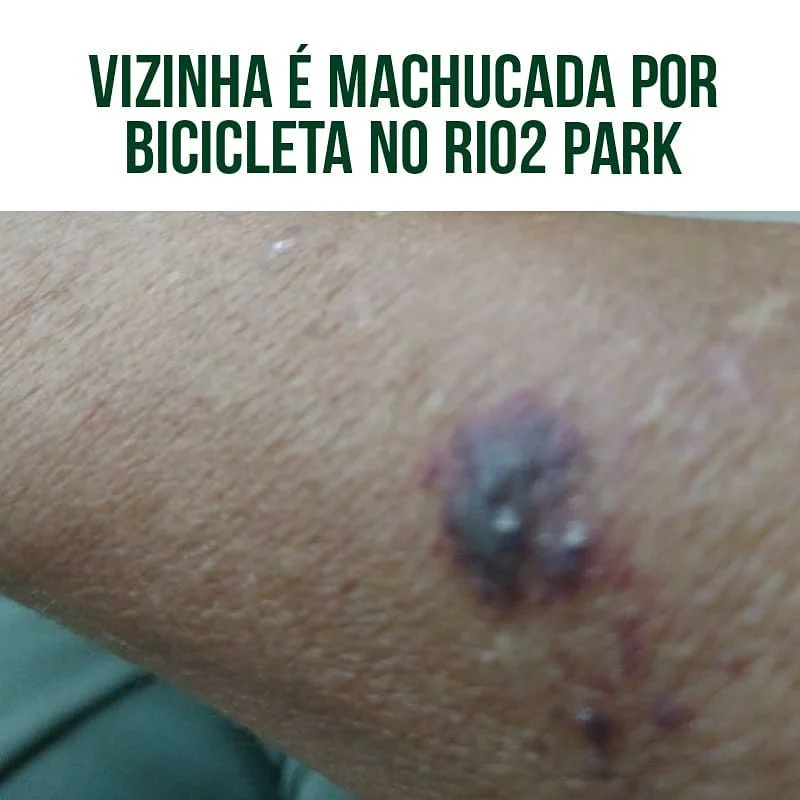 "Foi uma bicicleta da farmácia viva bem ( @farmaciavivabem_ ) q me machucou com guidom.