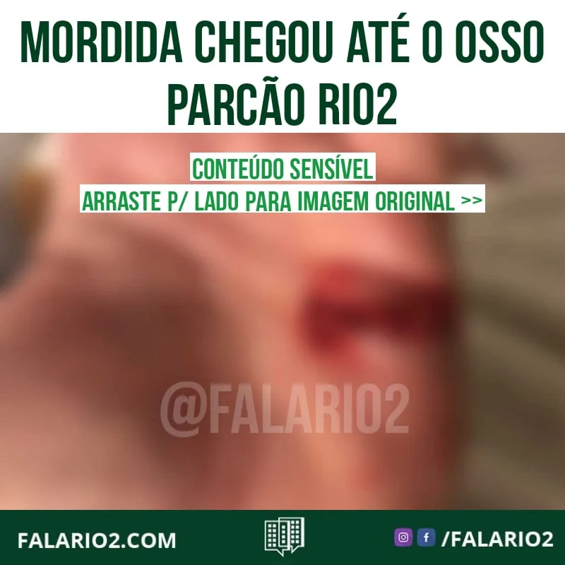 Na quarta-feira, dia 10/02, meu pai estava no parcao com o nosso cachorro por volta das 19hs.