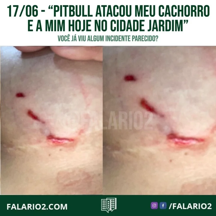 "Boa tarde, Pitbull atacou meu cachorro e a mim hoje no cidade jardim era umas 10:10 da manhã.