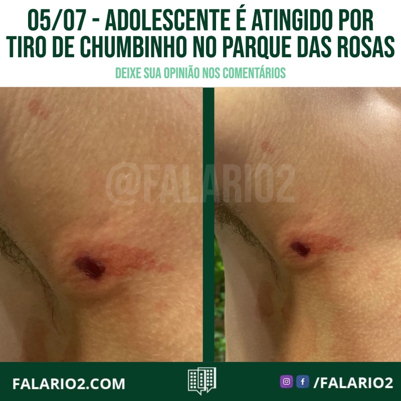 05/07 - Adolescente é atingido por tiro de chumbinho no Parque das Rosas